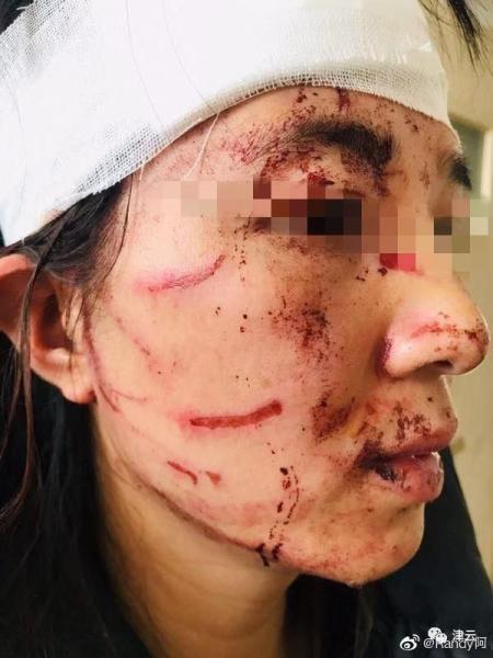 醉酒打妻子被反杀_男子醉酒杀妻_醉酒杀妻是故意还是过失