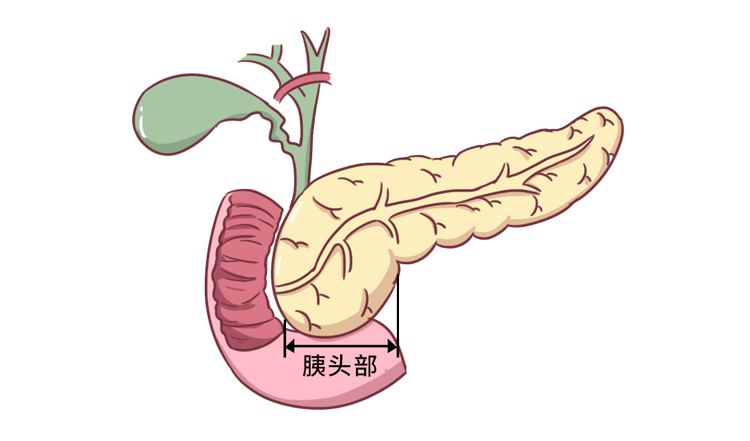 肝胆相照意思是什么_肝胆照应的意思_是肝胆相照的义气