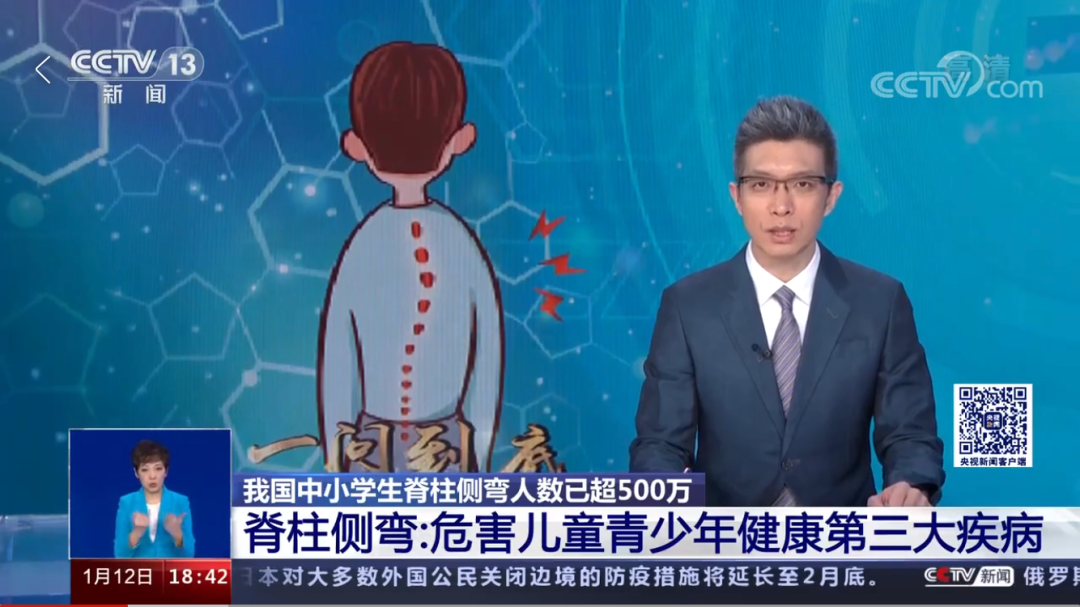 脊柱侧弯已纳入学生体检_脊柱侧弯会写入体检表吗_学校体检脊柱侧弯