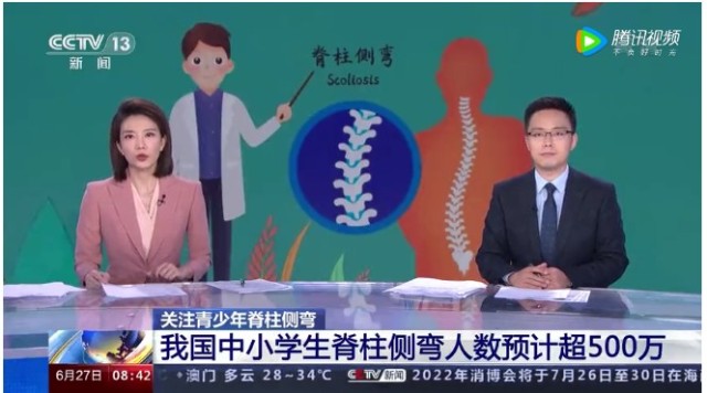 脊柱侧弯已纳入学生体检_脊柱侧弯会写入体检表吗_学校体检脊柱侧弯